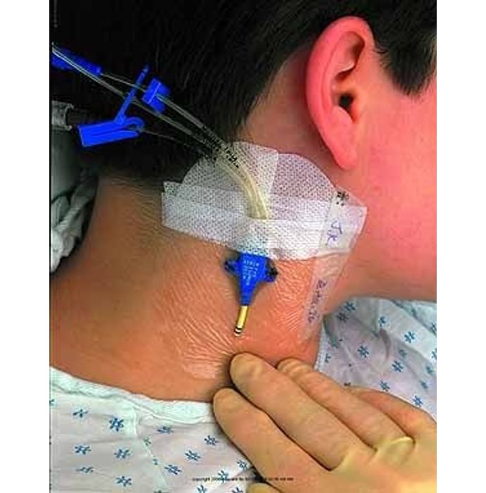 3M Tegaderm 1635 Central I.V. High Secural Dressing
packet of 50 films